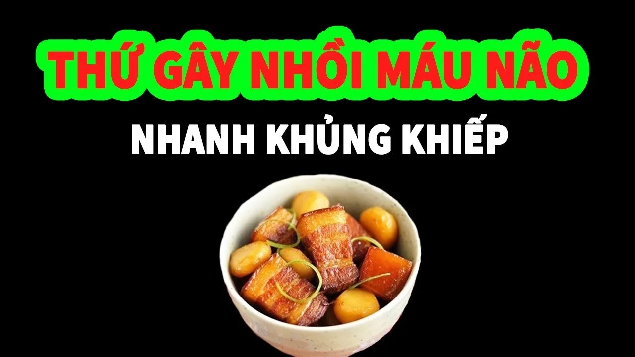 Đột Quỵ Nhồi Máu Não Chỉ Vì Thịt Kho - SKST