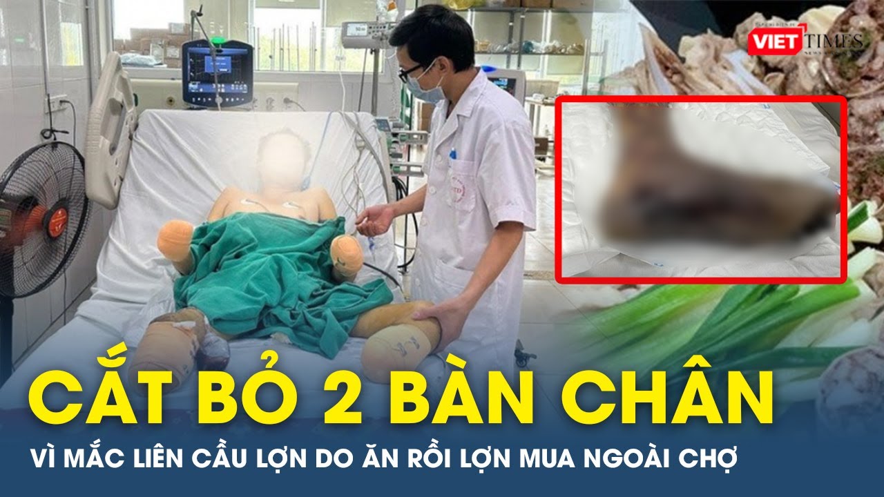 Cắt bỏ hai bàn chân và các ngón tay do ăn dồi lợn mua ngoài chợ | VTs