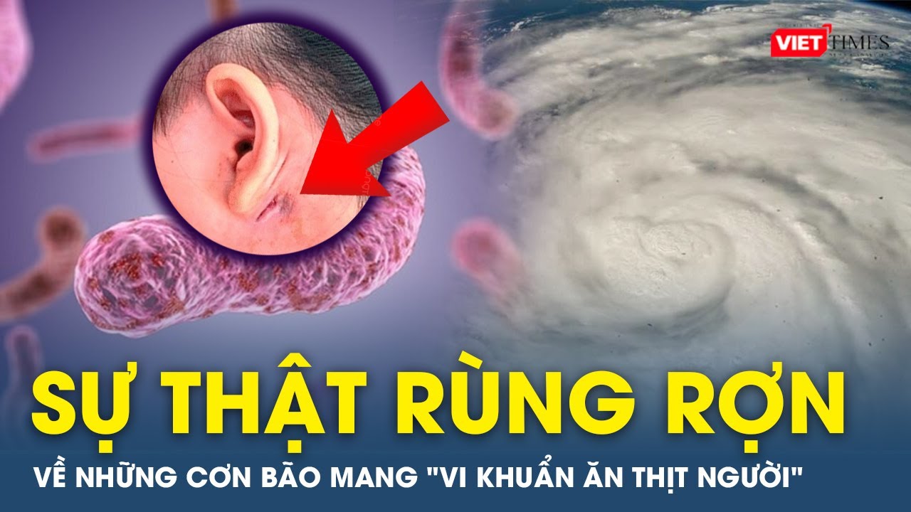 Sự thật rùng rợn về những cơn bão mang "Vi khuẩn ăn thịt người" tấn công chúng ta | VTs