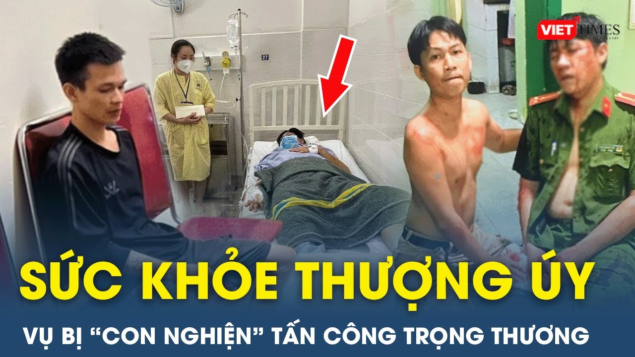 Vụ “con nghiện” tấn công Thượng úy Công an trọng thương: Nạn nhân đã qua cơn nguy kịch | VietTimes