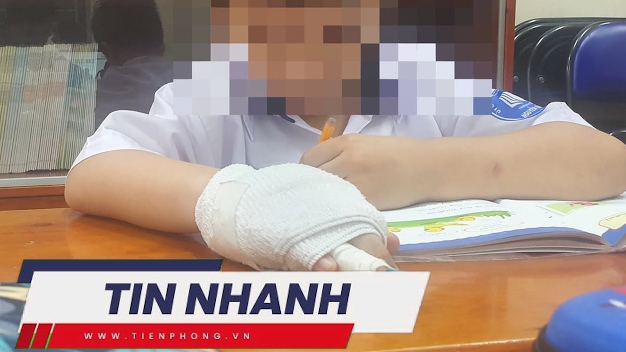 TIN NHANH: Nhà trường thông tin vụ học sinh lớp 1 bị cô giáo đánh gãy ngón tay; Cháy nổ kinh hoàng