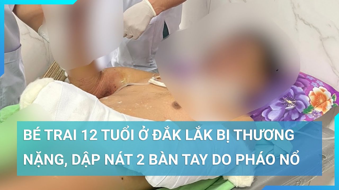 Bé trai 12 tuổi ở Đắk Lắk bị thương nặng, dập nát 2 bàn tay do pháo nổ | Cuộc sống 24h