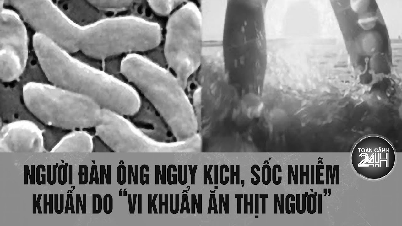 Người đàn ông nguy kịch, sốc nhiễm khuẩn do “vi khuẩn ăn thịt người” | Toàn cảnh 24h