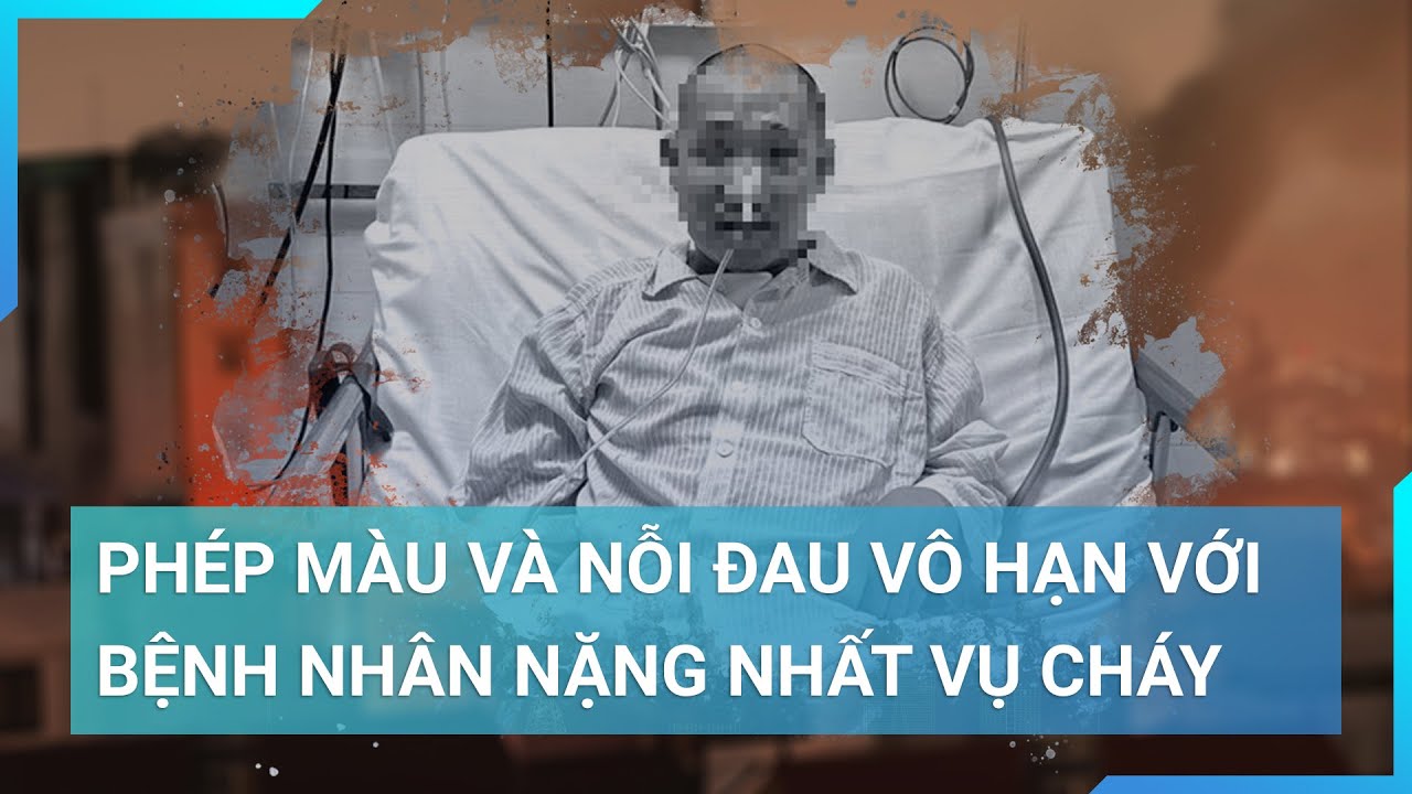 Vụ cháy chung cư mini: Bệnh nhân nặng nhất hồi phục như kỳ tích nhưng mất vợ con | Cuộc sống 24h