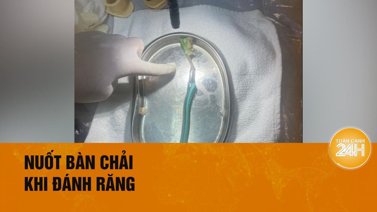 Đau bụng dữ dội vì vô tình nuốt bàn chải vào bụng khi đánh răng| Toàn cảnh 24h