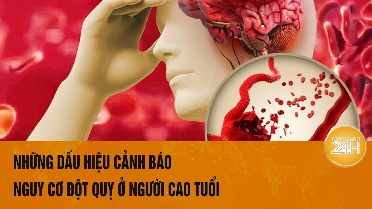 Những dấu hiệu cảnh báo nguy cơ đột quỵ ở người cao tuổi | Toàn cảnh 24h