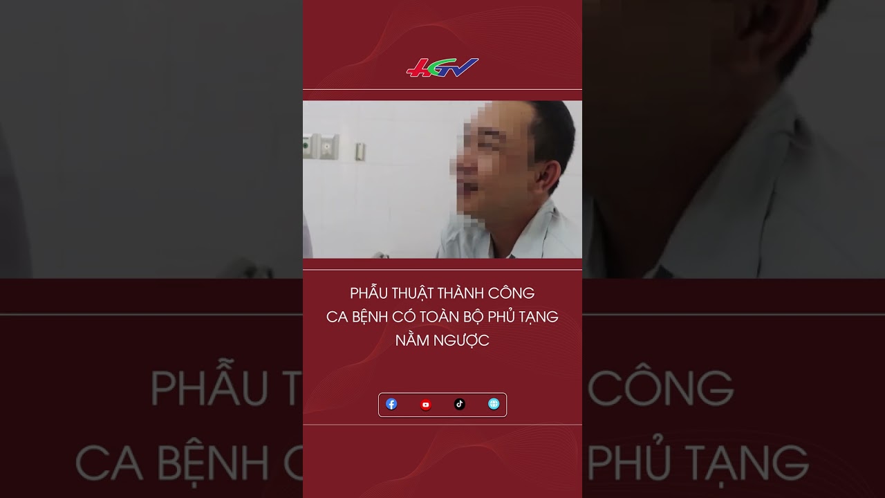 Phẫu thuật thành công ca bệnh có toàn bộ phủ tạng nằm ngược #shorts | Truyền hình Hậu Giang