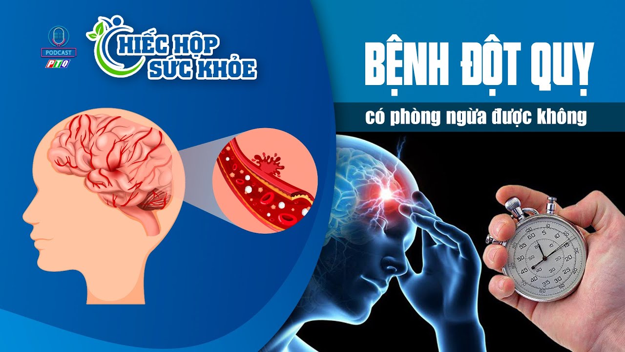 Dấu hiệu sớm của bệnh đột quỵ | PODCAST