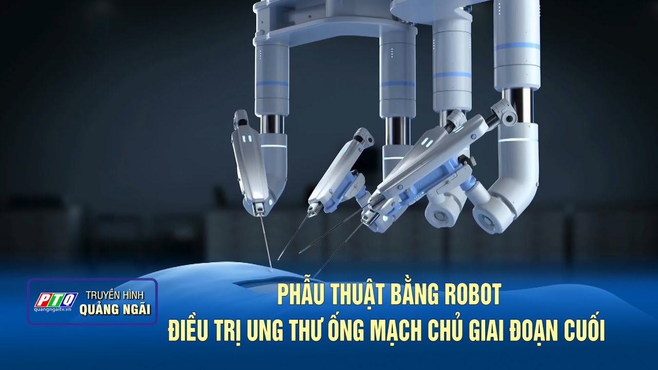 Phẫu thuật bằng robot điều trị ung thư ống mạch chủ giai đoạn cuối  | PTQ