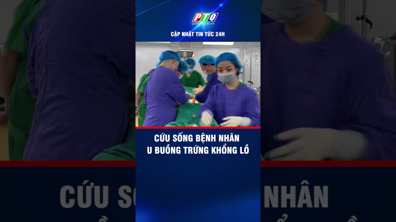 Cứu sống bệnh nhân u buồng trứng khổng lồ | PTQ