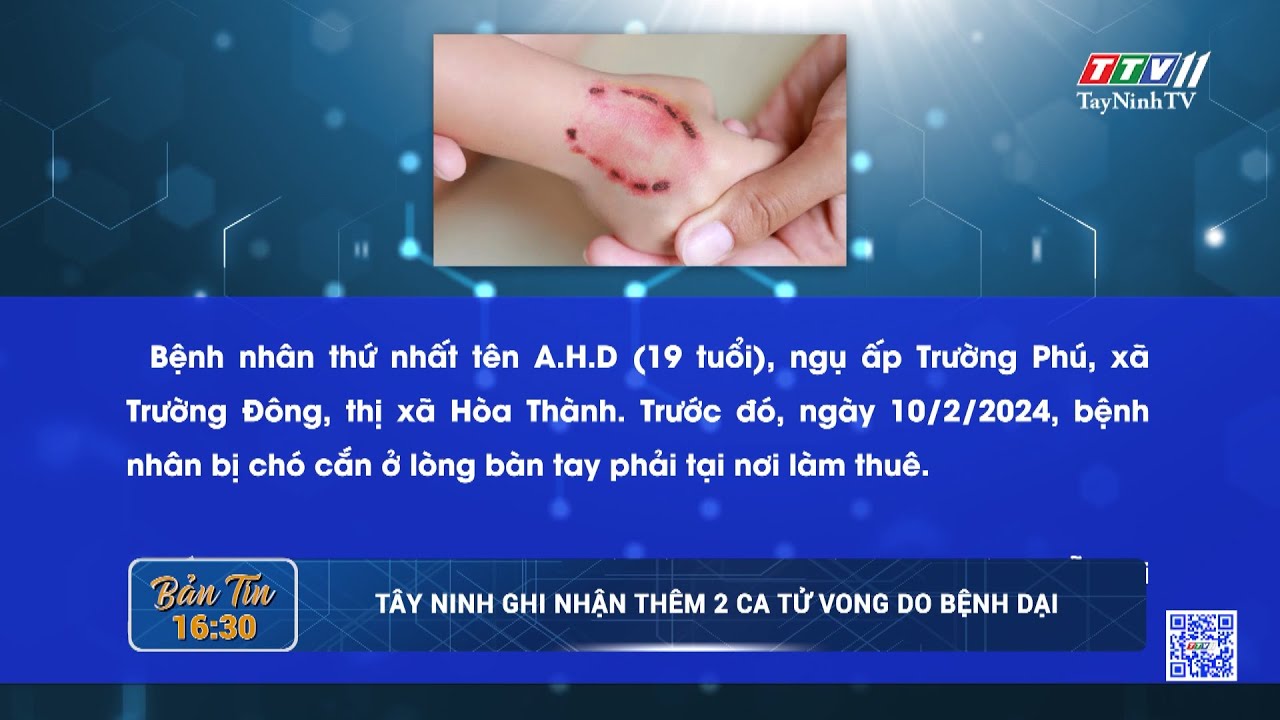 Tây Ninh ghi nhận thêm 2 ca t*ử vo*n*g do bệnh dại | TayNinhTV