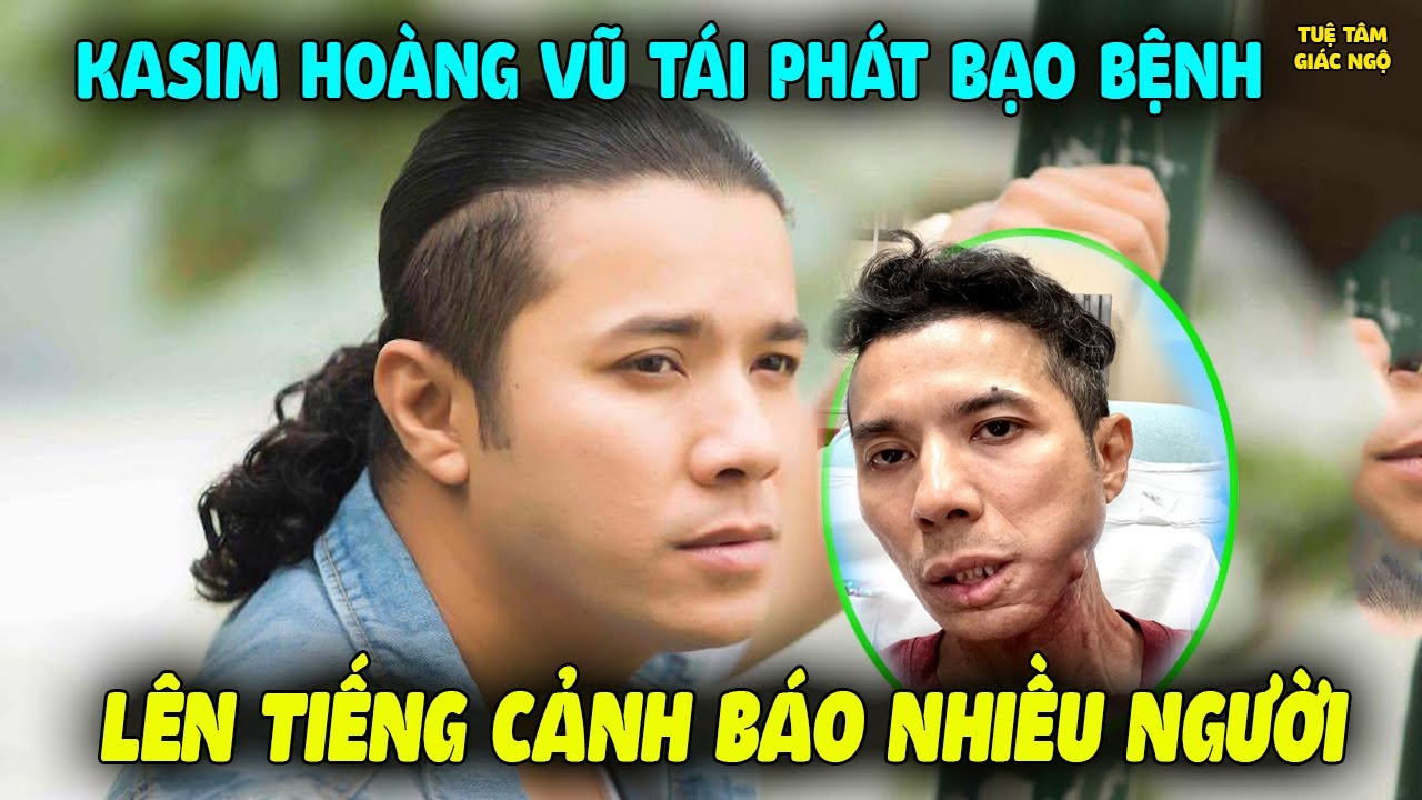 Kasim Hoàng Vũ Tái Phát Bạo Bệnh LÊN TIẾNG CẢNH BÁO Sức Khỏe Đến Nhiều Người