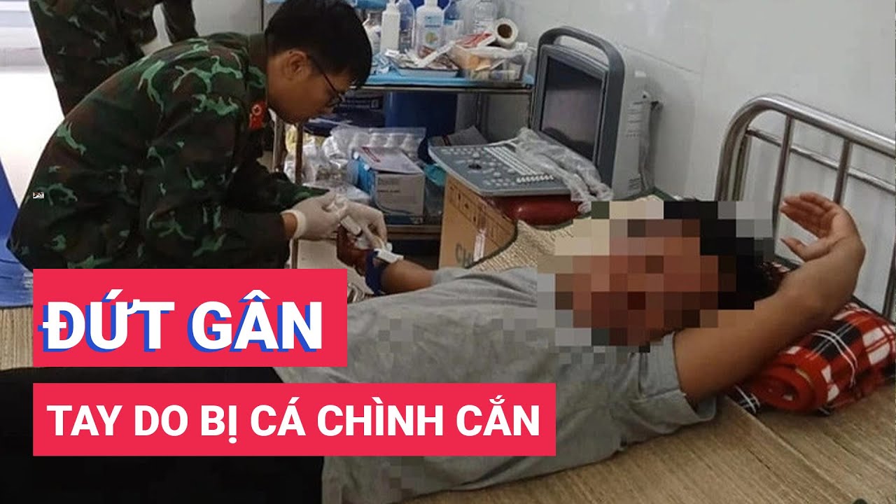 Một ngư dân Quảng Ngãi bị cá chình cắn đứt gân tay