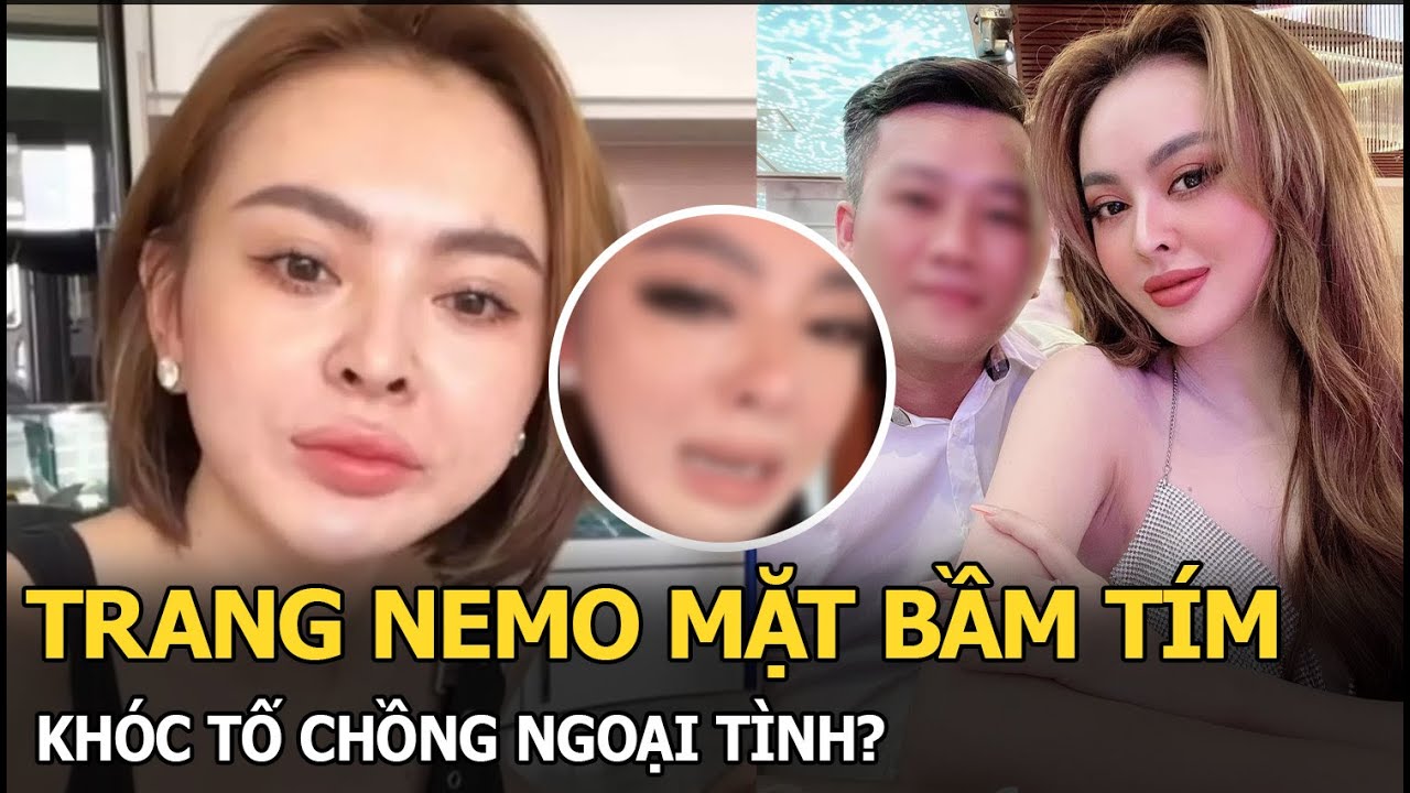 Trang Nemo mặt bầm tím, khóc tố chồng ngoại tình?