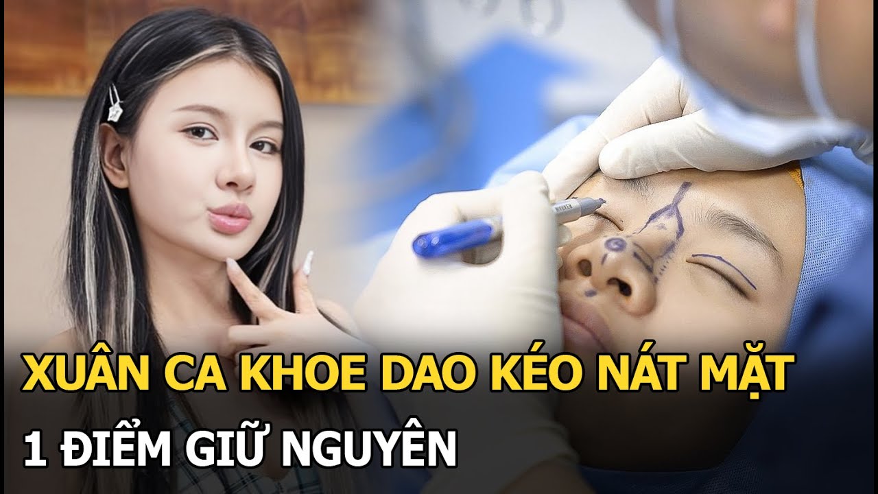 Xuân Ca khoe dao kéo nát mặt, 1 điểm giữ nguyên