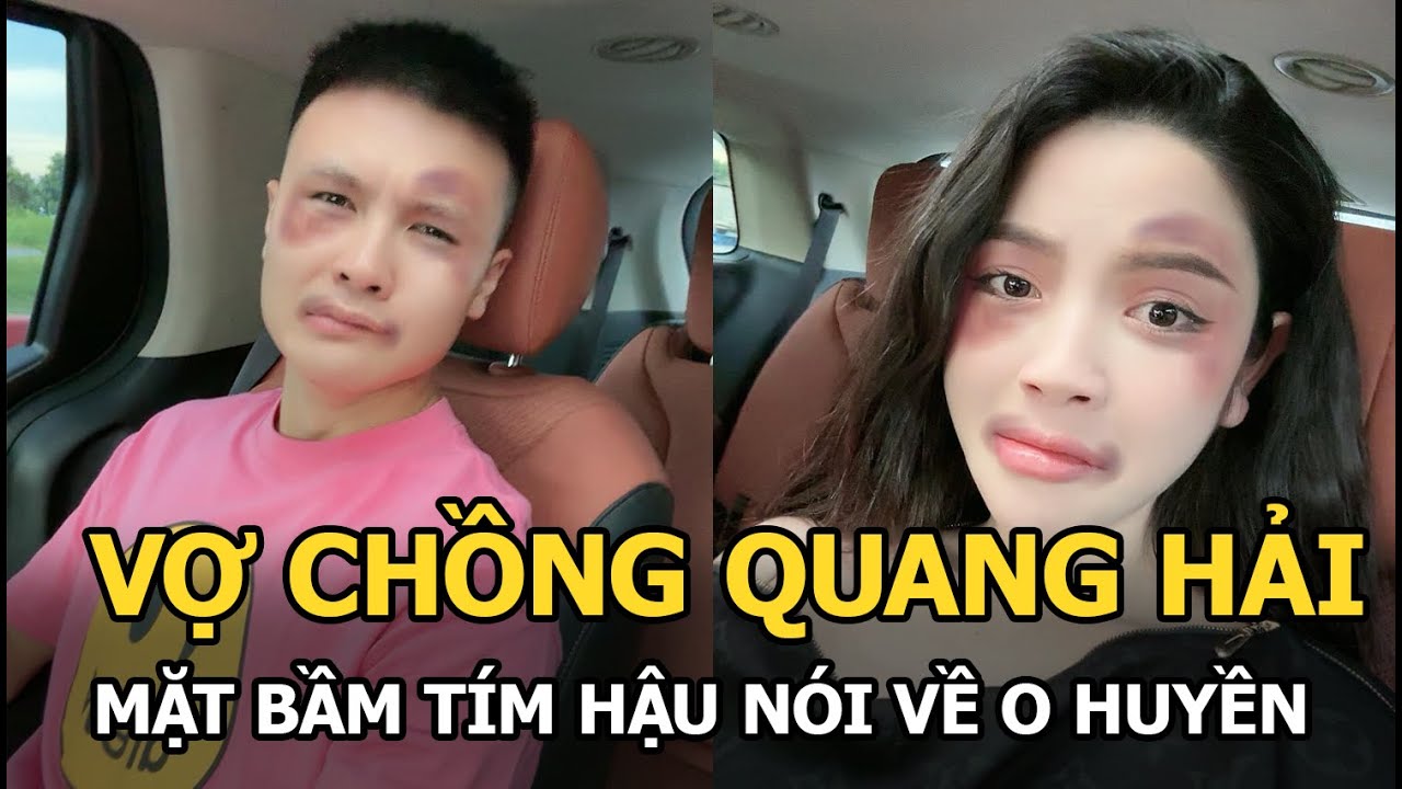 Vợ chồng Quang Hải: Mặt bầm tím hậu nói về O Huyền