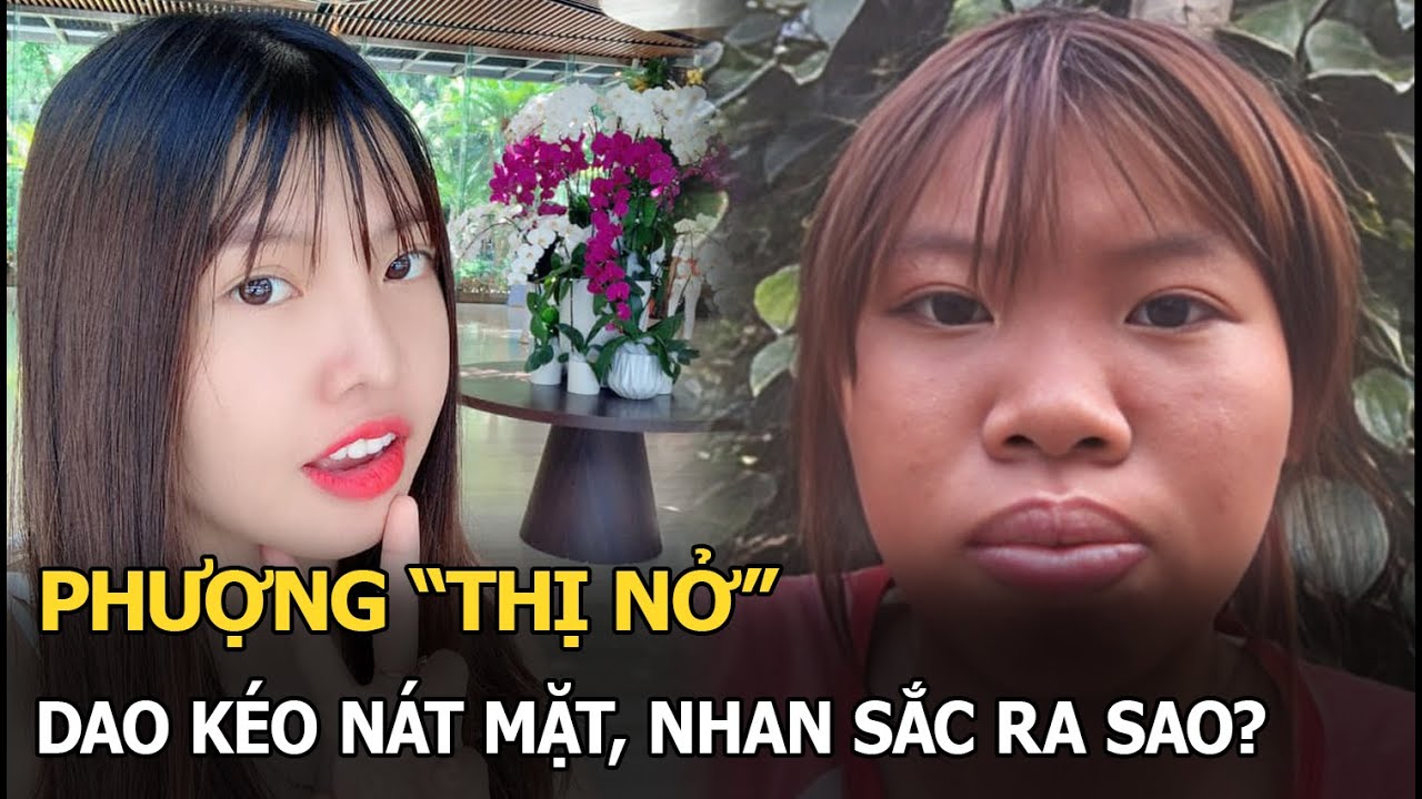 Phượng "Thị Nở" dao kéo nát mặt, nhan sắc ra sao?