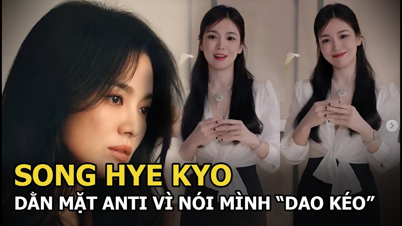 Song Hye Kyo “dằn mặt” anti-fan vì nói mình can thiệp “dao kéo”, bất ngờ để lộ điểm khác thường ngày