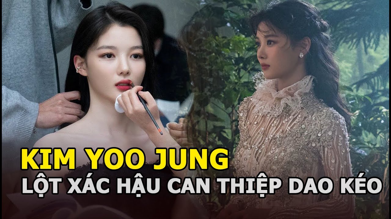 Em gái quốc dân Kim Yoo Jung lột xác hậu can thiệp dao kéo, bật mí chuyện kết hôn vì lợi ích gây bão