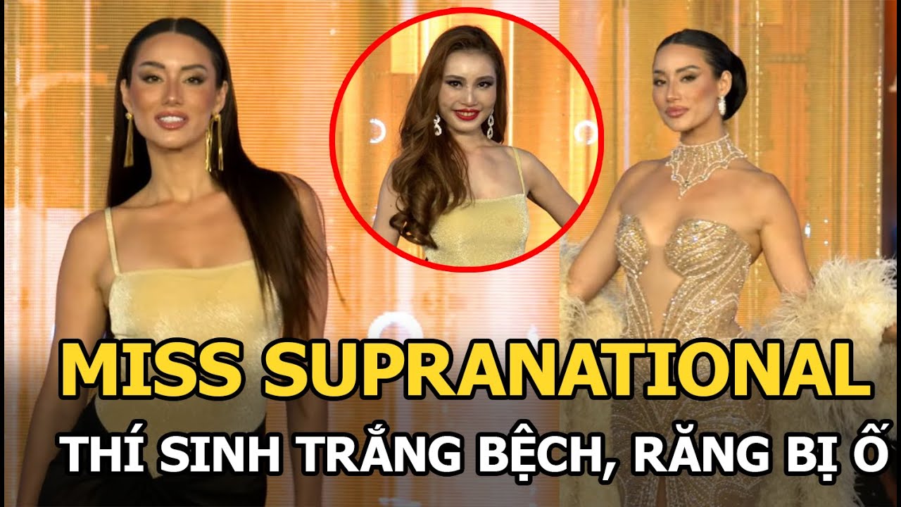 Miss Supranational: Thí sinh trắng bệch, răng bị ố