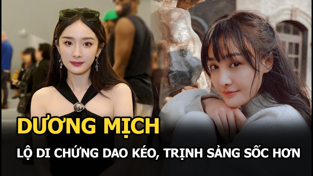 Dương Mịch lộ di chứng dao kéo, Trịnh Sảng sốc hơn