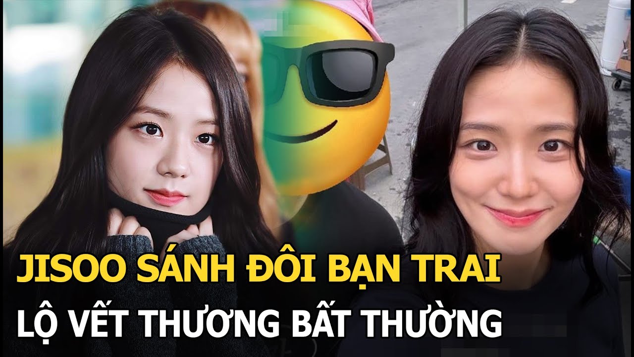 Jisoo sánh đôi bạn trai, lộ vết thương bất thường