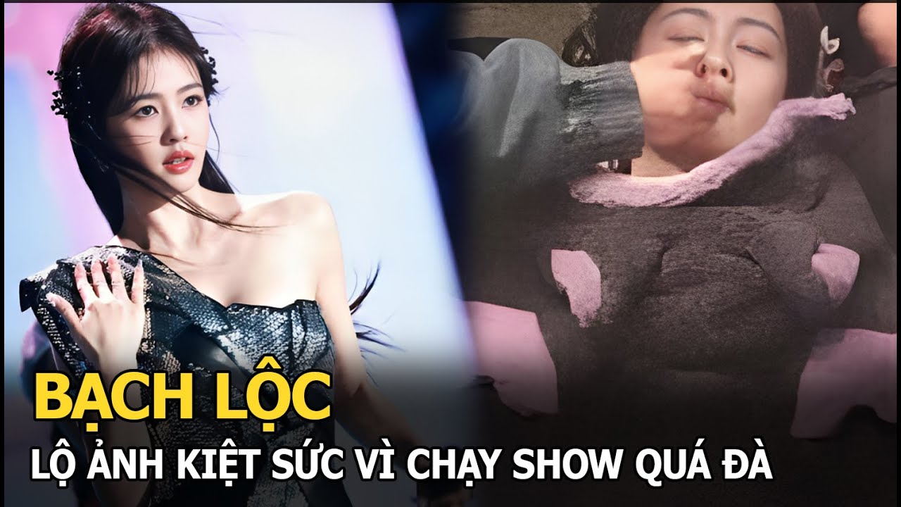 Bạch Lộc lộ ảnh kiệt sức vì chạy show quá đà