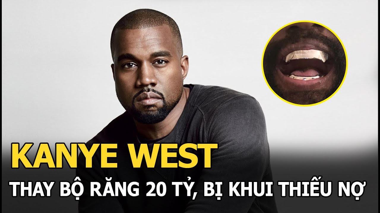 Kanye West thay bộ răng 20 tỷ, bị khui thiếu nợ