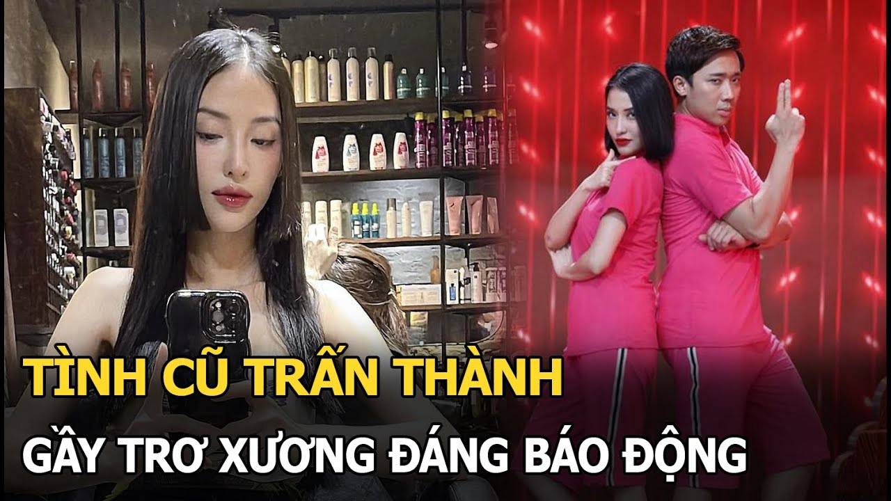 Tình cũ Trấn Thành gầy trơ xương đáng báo động