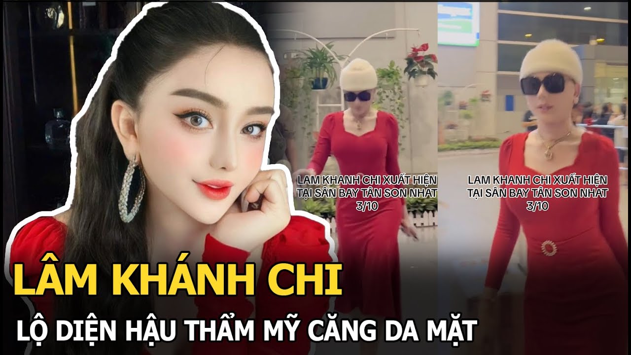 Lâm Khánh Chi lộ diện hậu thẩm mỹ căng da mặt, thần sắc nhợt nhạt, cam thường khác xa ảnh tự đăng