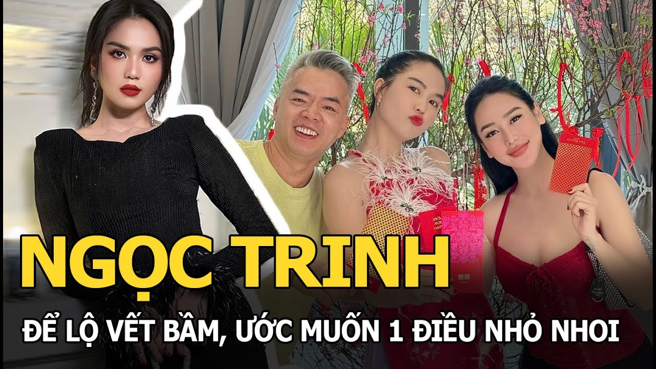 Ngọc Trinh để lộ vết bầm, ước muốn 1 điều nhỏ nhoi