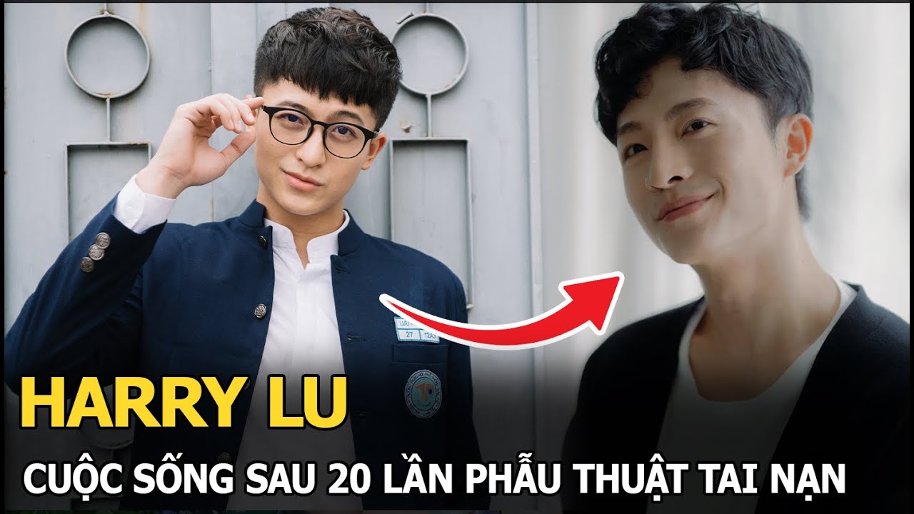 Harry Lu cuộc sống sau 20 lần phẫu thuật tai nạn