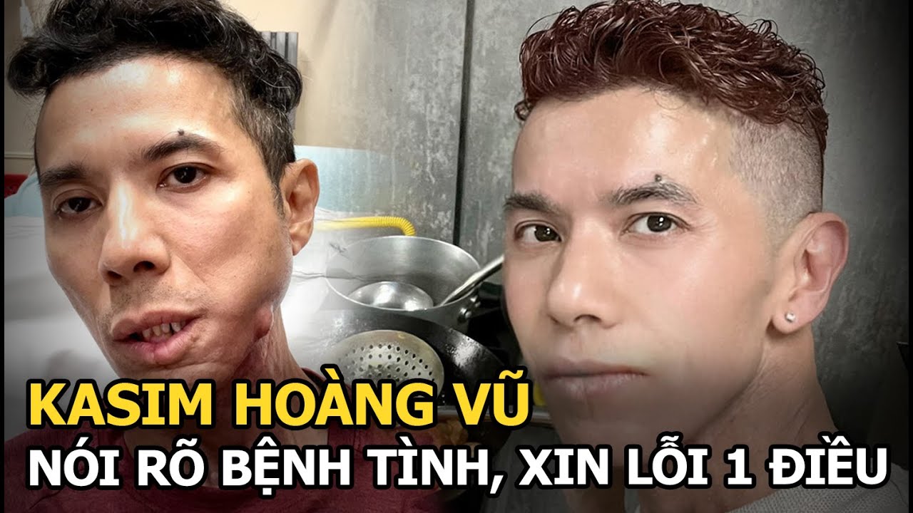 Kasim Hoàng Vũ nói rõ bệnh tình, xin lỗi 1 điều