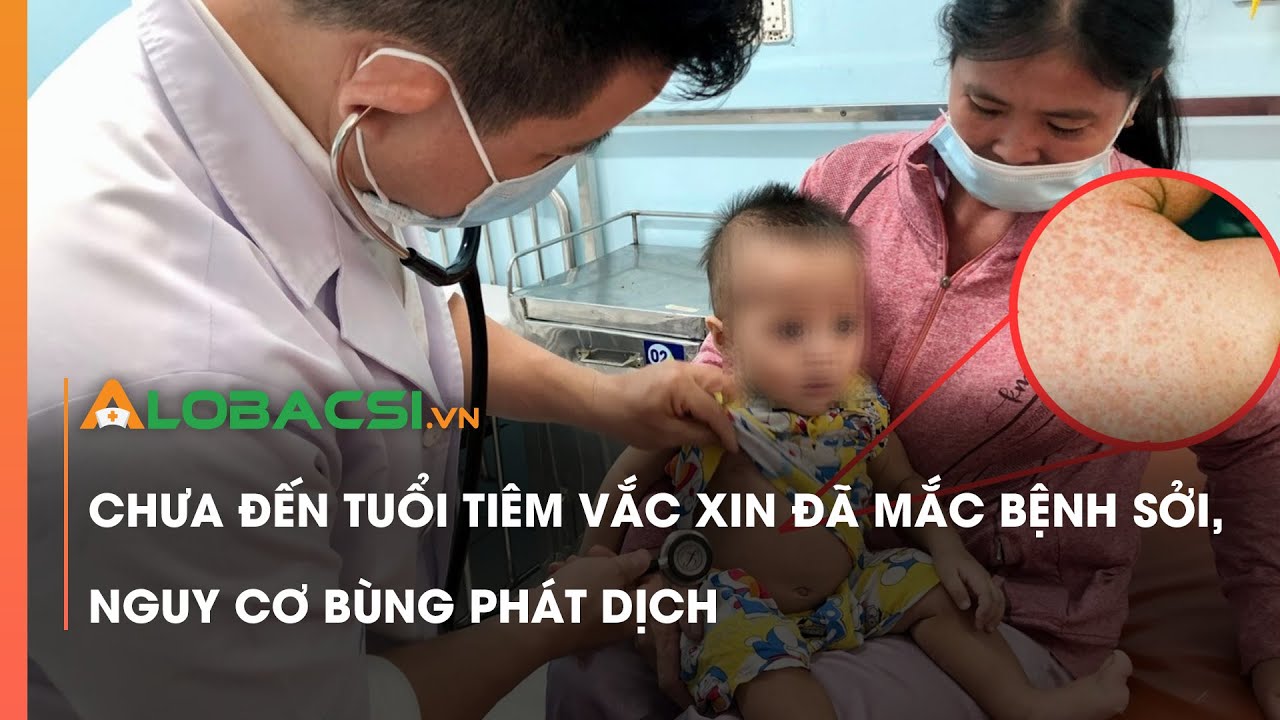 Chưa đến tuổi tiêm vắc xin đã mắc bệnh sởi, nguy cơ bùng phát dịch