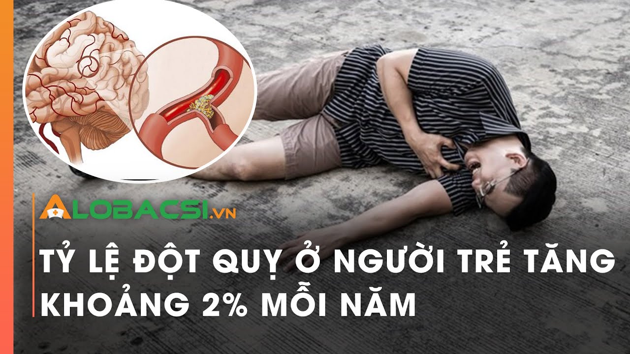 Tỷ lệ đột quỵ ở người trẻ tăng khoảng 2% mỗi năm