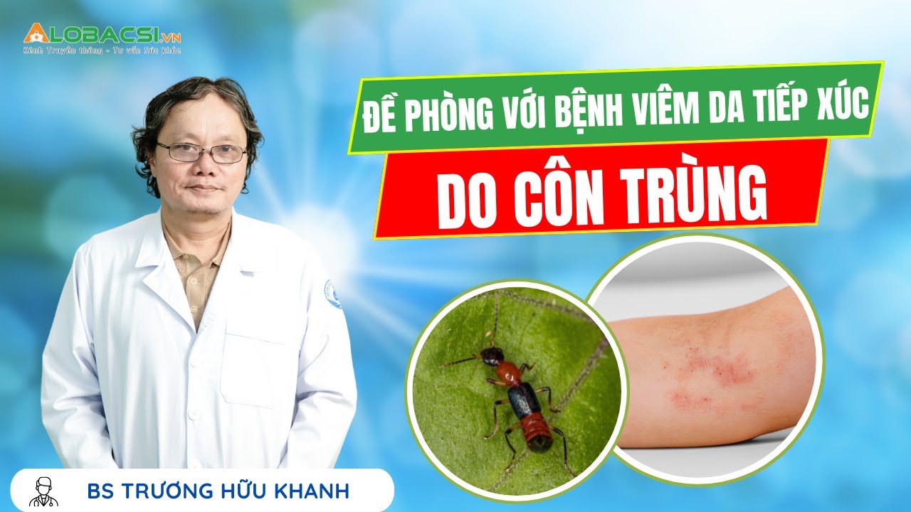 Đề phòng với bệnh viêm da tiếp xúc do côn trùng | BS Trương Hữu Khanh | Video Alobacsi