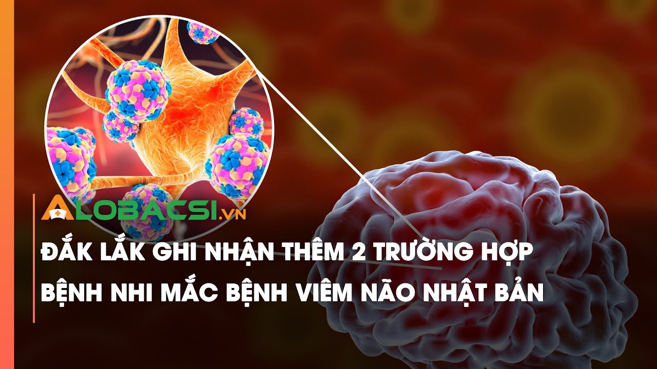 Đắk Lắk ghi nhận thêm 2 trường hợp bệnh nhi mắc bệnh viêm não Nhật Bản