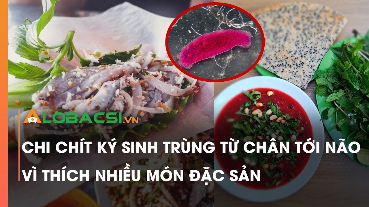 Chi chít ký sinh trùng từ chân tới não vì thích nhiều món đặc sản