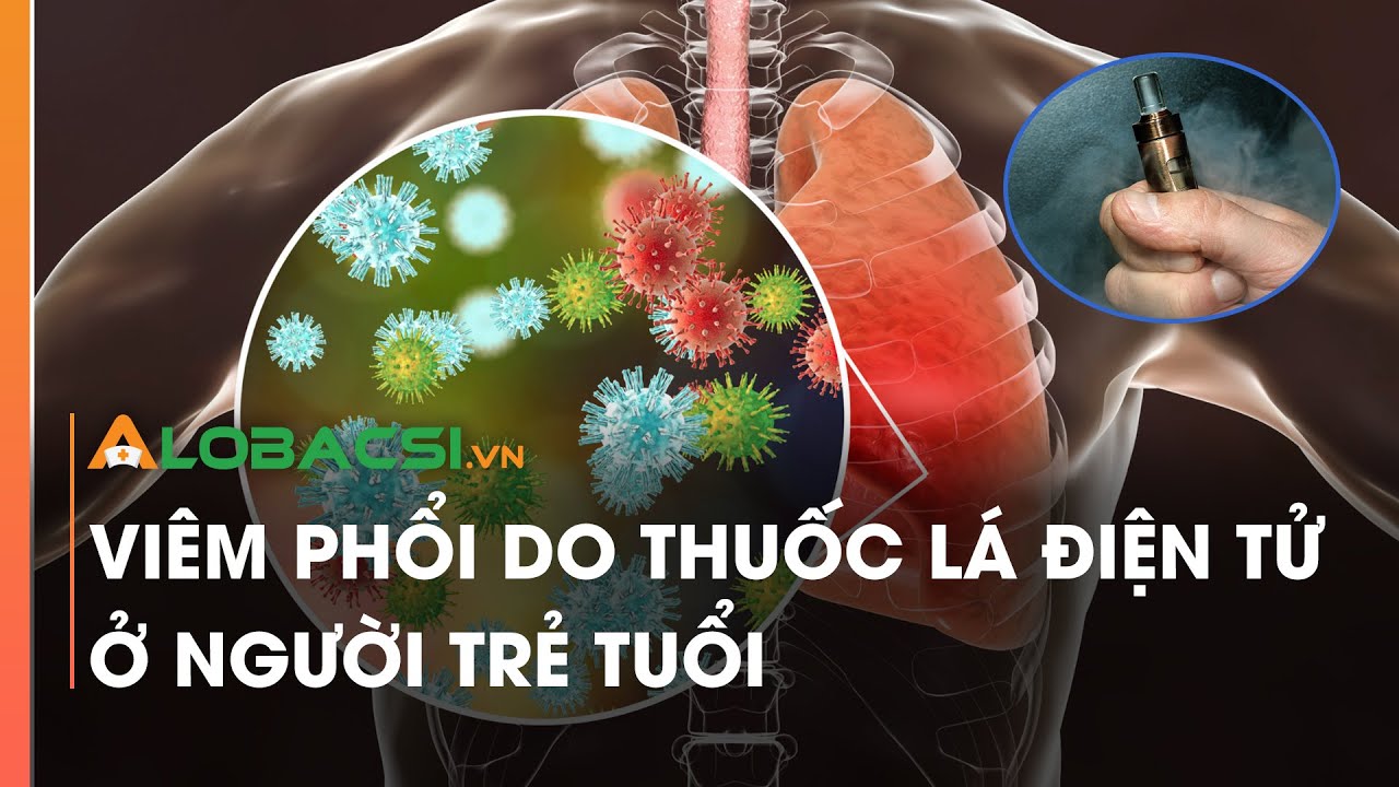 Viêm phổi do thuốc lá điện tử ở người trẻ tuổi