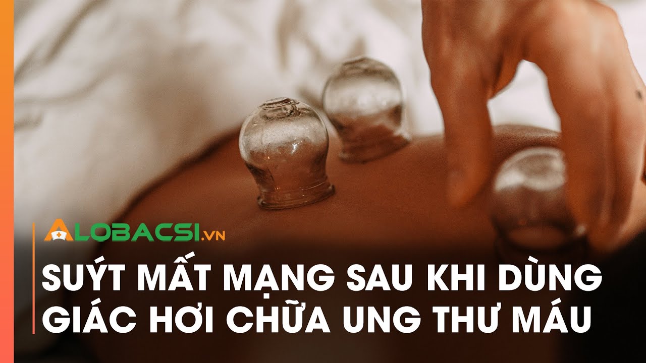 Suýt mất mạng sau khi dùng giác hơi chữa ung thư máu | Video Alobacsi