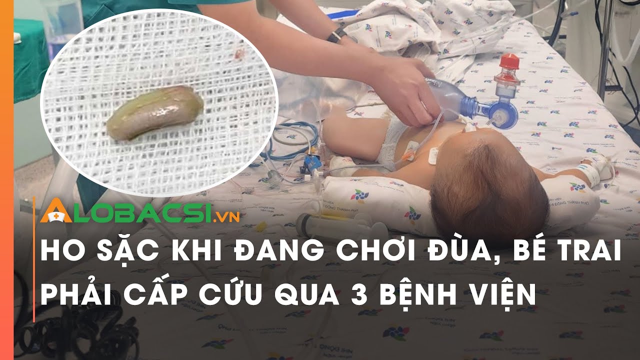 Ho sặc khi đang chơi đùa, bé trai phải cấp cứu qua 3 bệnh viện