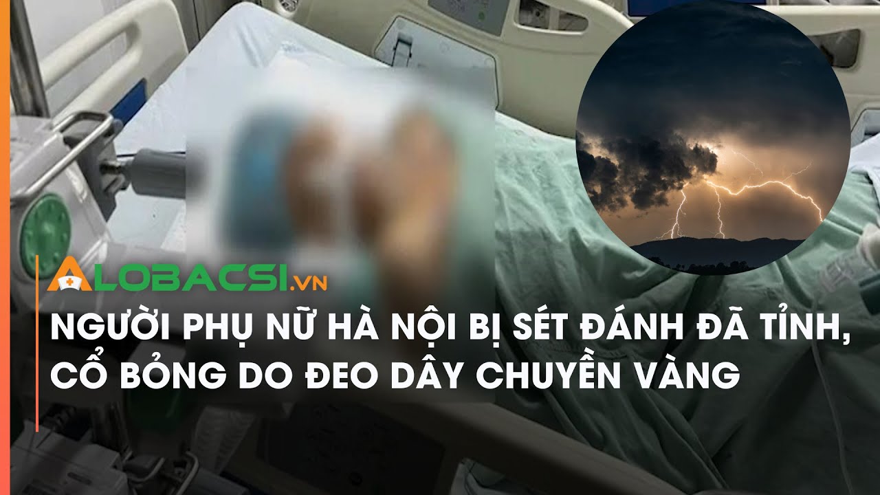 Người phụ nữ Hà Nội bị sét đánh đã tỉnh, cổ bỏng do đeo dây chuyền vàng