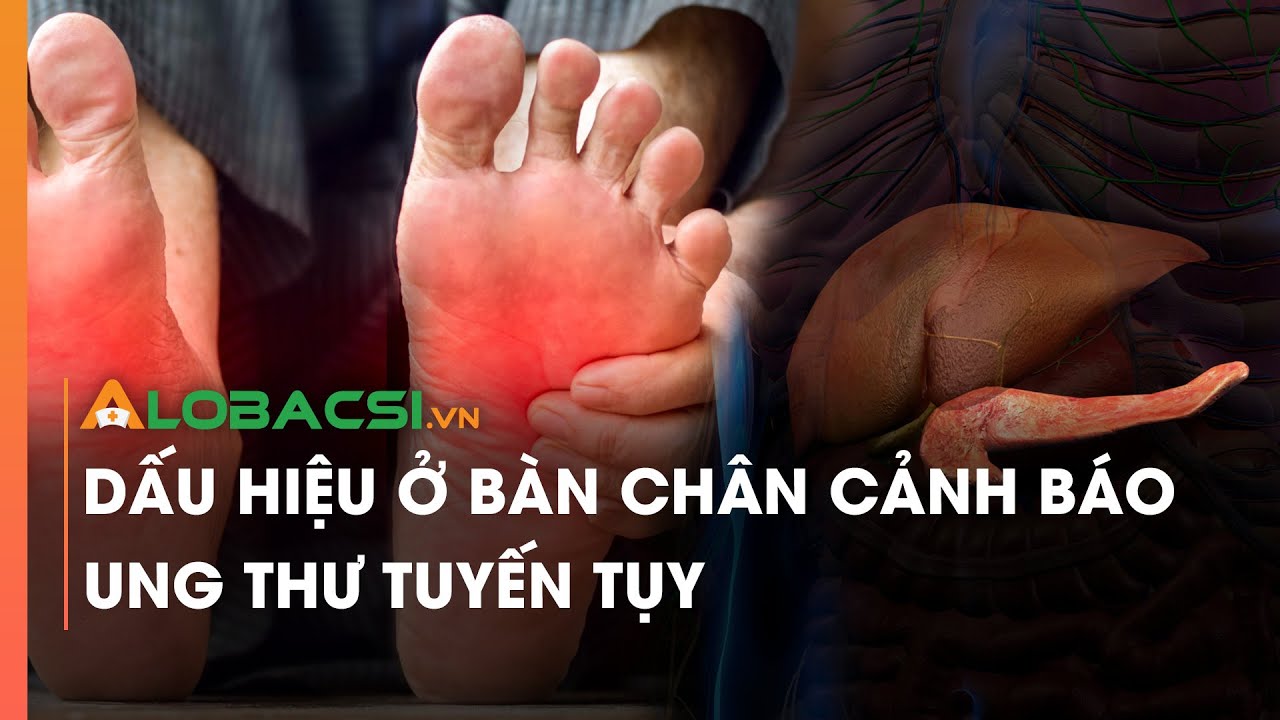 Dấu hiệu ở bàn chân cảnh báo ung thư tuyến tụy