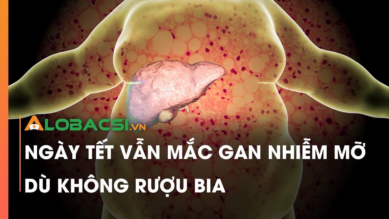 Ngày Tết vẫn mắc gan nhiễm mỡ dù không rượu bia