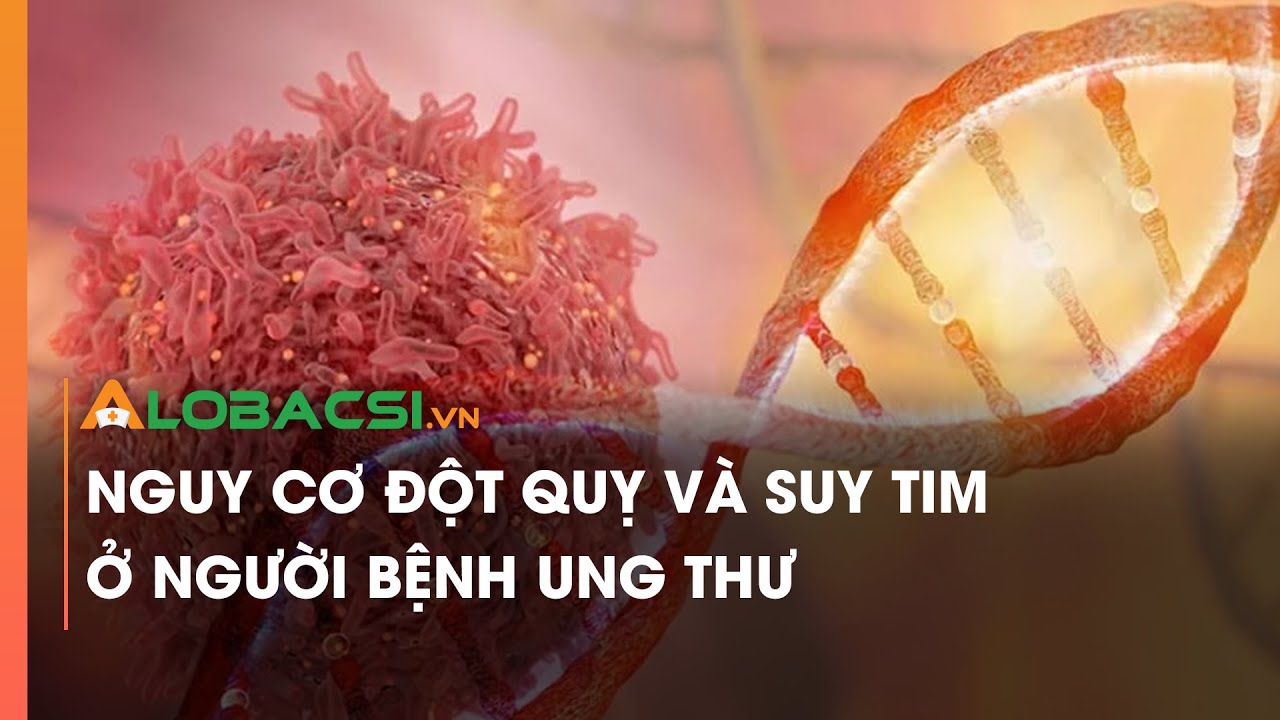 Nguy cơ đột quỵ và suy tim ở người bệnh ung thư