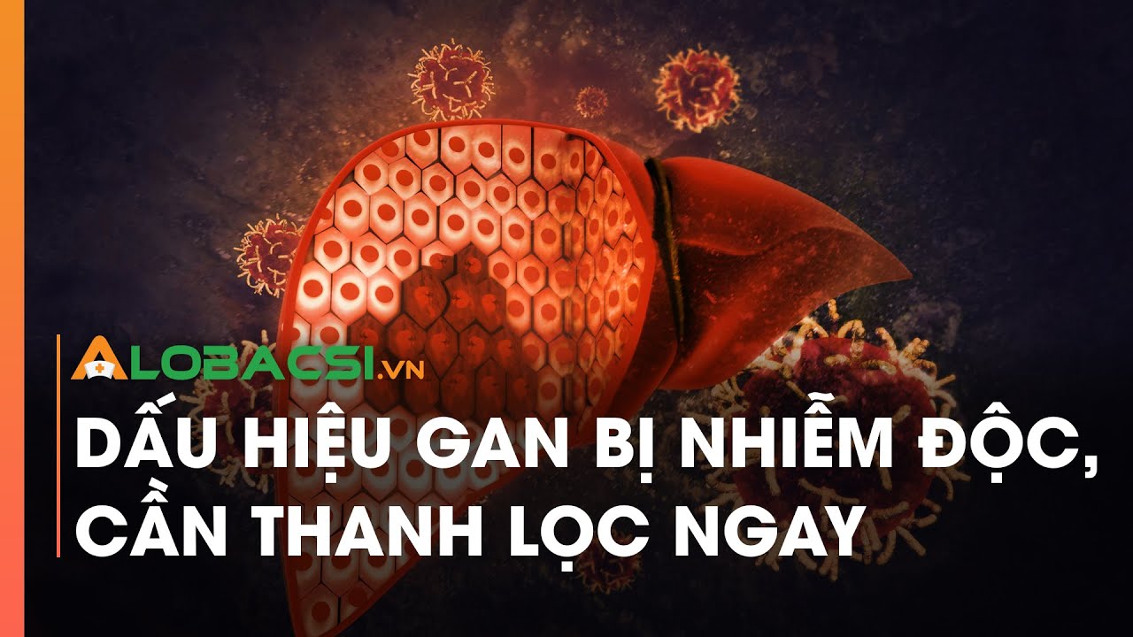 Dấu hiệu gan bị nhiễm độc, cần thanh lọc ngay