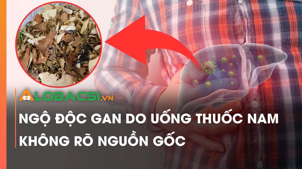 Ngộ độc gan do uống thuốc nam không rõ nguồn gốc