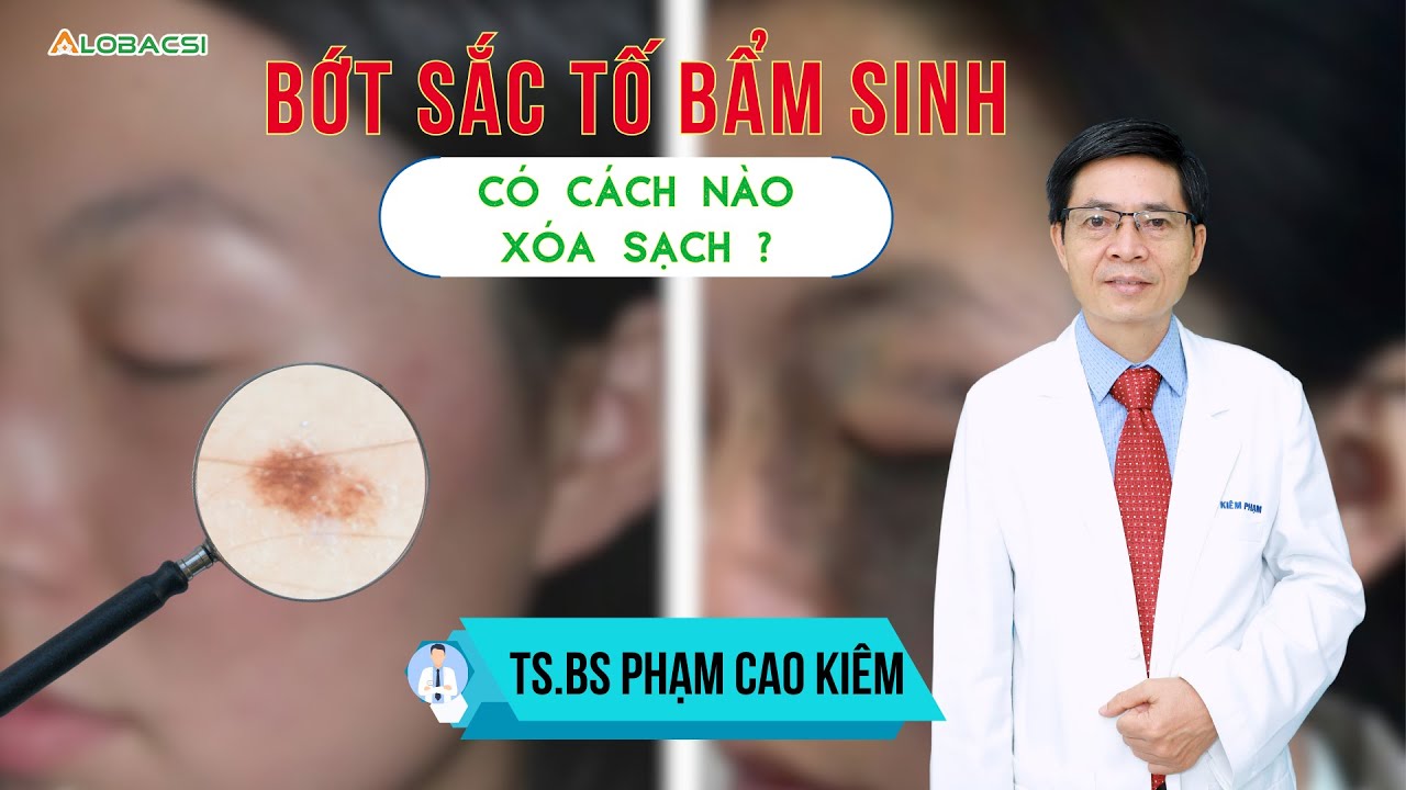 Bớt sắc tố bẩm sinh, có cách nào xóa sạch?  | TS.BS Phạm Cao Kiêm