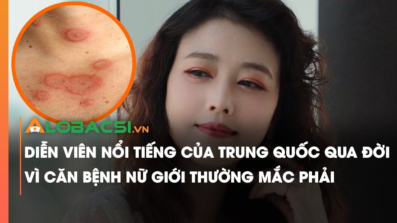 Diễn viên nổi tiếng của Trung Quốc qua đời vì căn bệnh nữ giới thường mắc phải