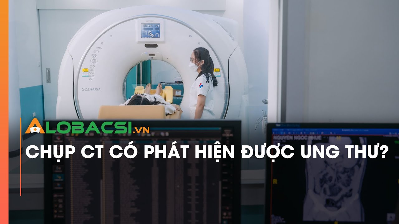 Chụp CT có phát hiện được ung thư?